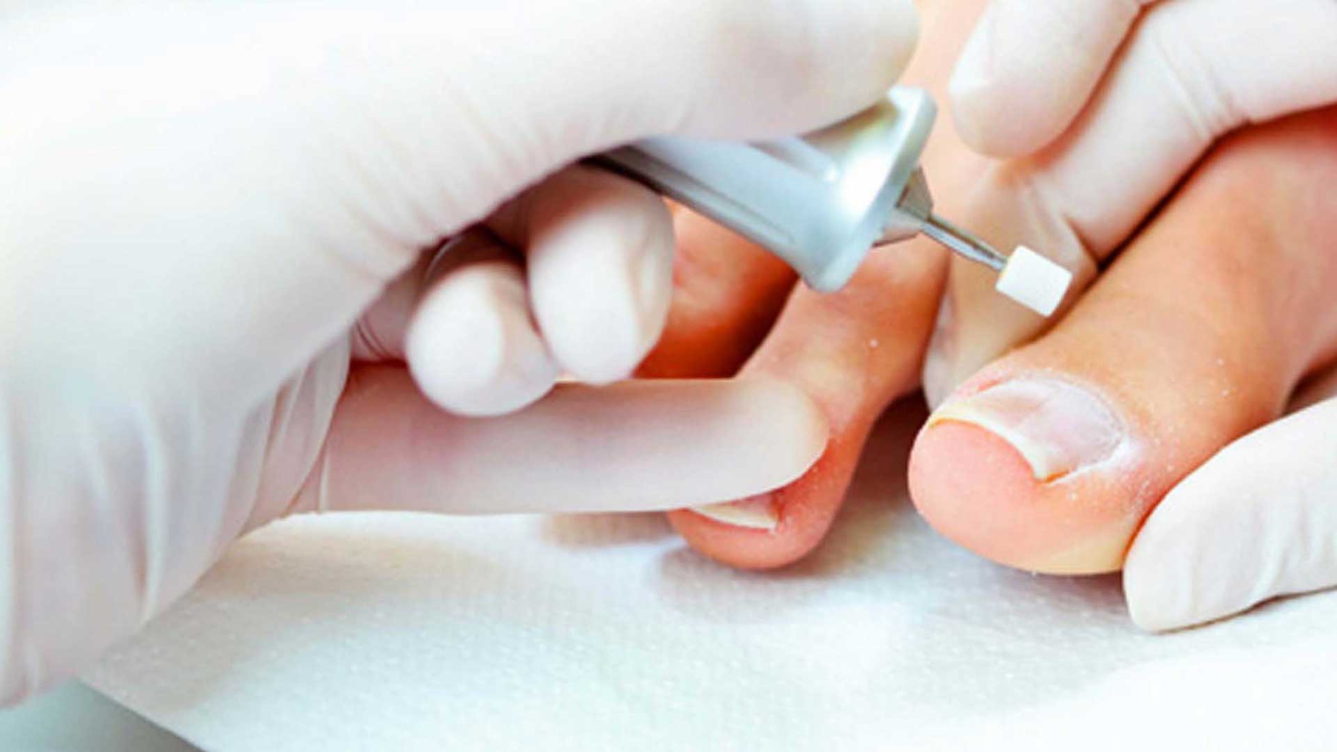 Pedicure in Nuenen – Professionele Voetverzorging bij Happy Skin Pedicure in Nuenen – Professionele Voetverzorging bij Happy Skin