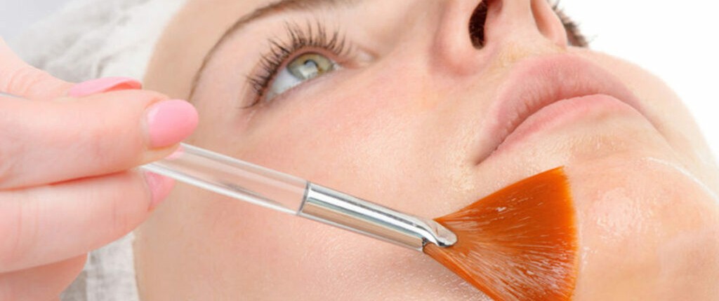 Medische peeling