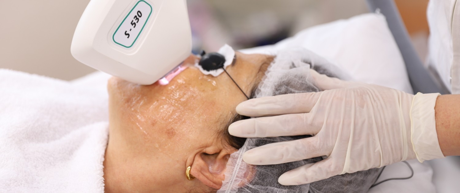 Medische peeling