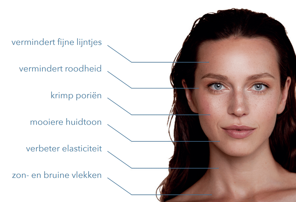 full face ipl Huidverjonging Skinrejuvenation