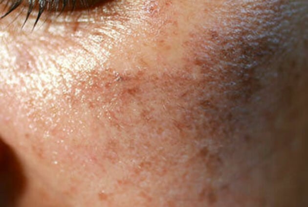 5-vragen-pigment-4x4