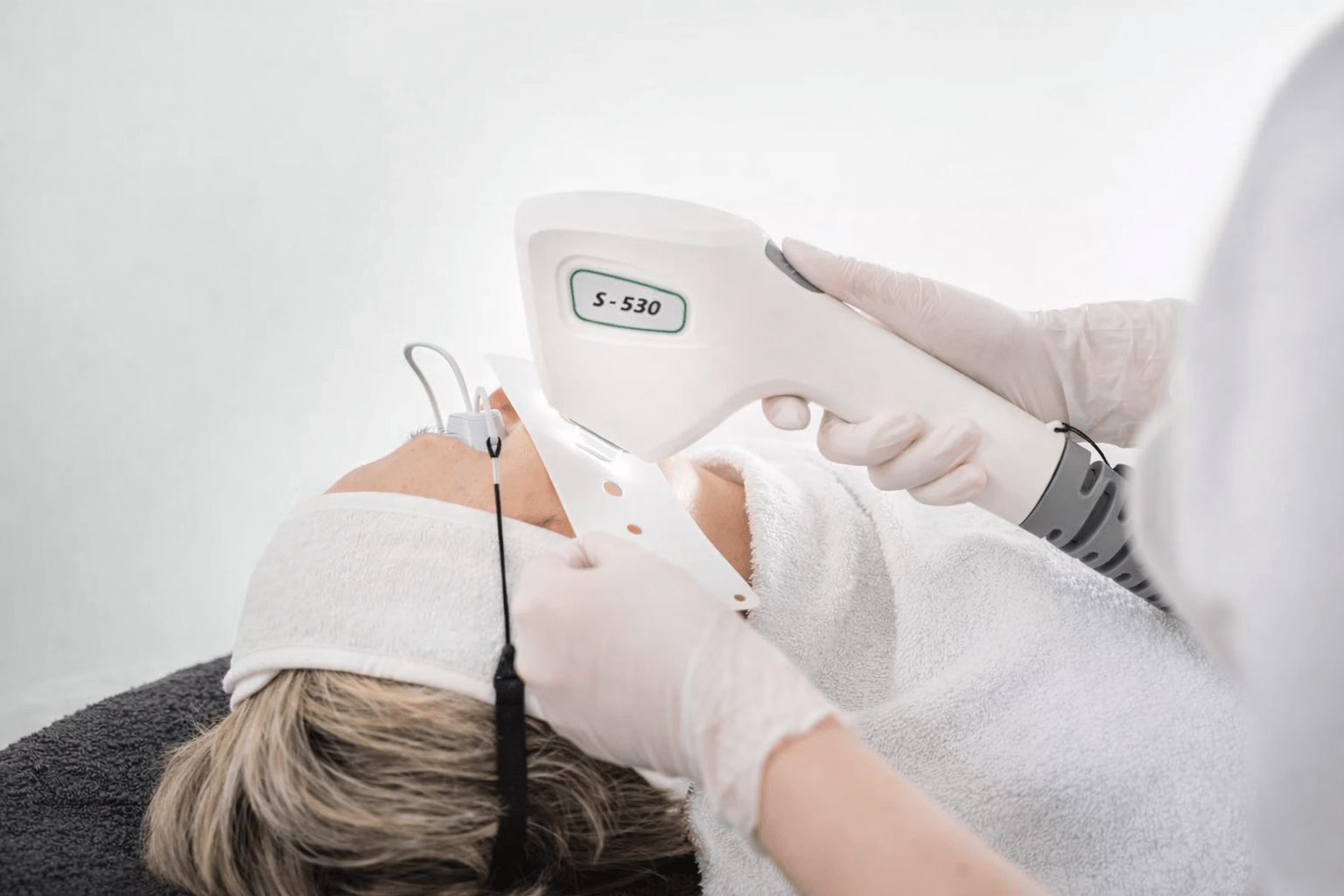 IPL cherry agioma happy skin nuenen