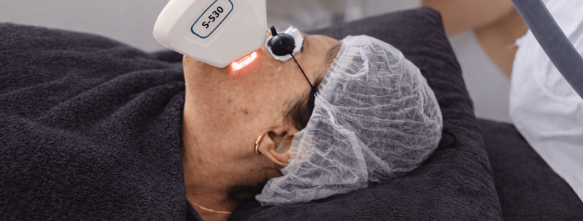 IPL PIGMENTBEHANDELING IPL PIGMENTBEHANDELING