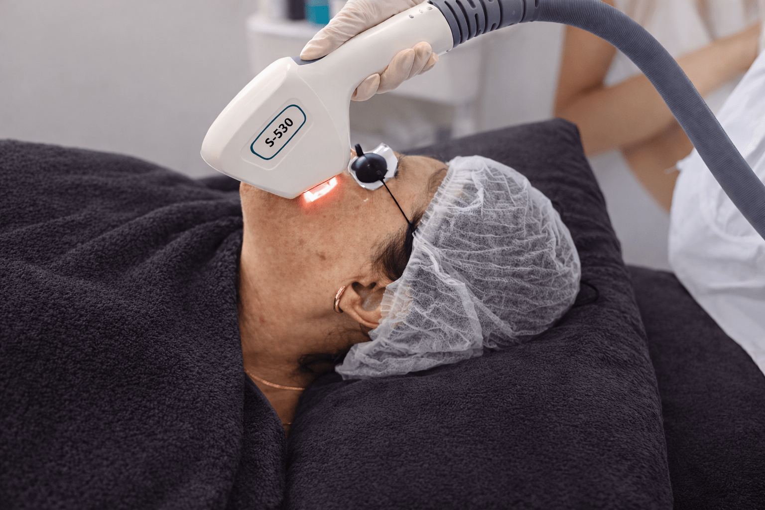 IPL laserbehandeling happy skin